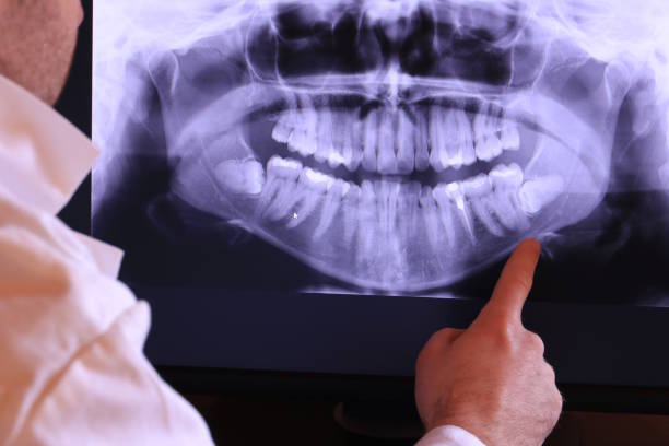 Best Emergency Dental Care for Abscessed Tooth in Crewe, VA