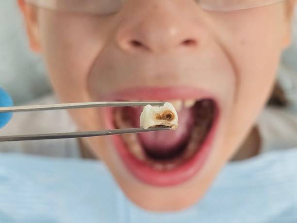 Best Weekend Emergency Dentist in Crewe, VA